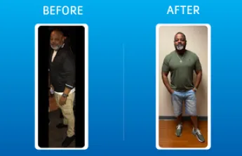 Kirk's before and after