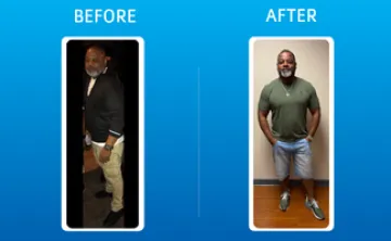 Kirk's before and after